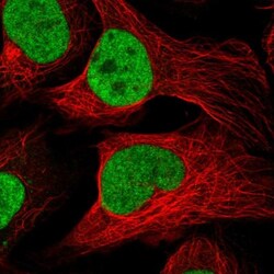 MINDY2 Antibody, Novus Biologicals 0.1mL; Unlabeled:Antibodies, Polyclonal